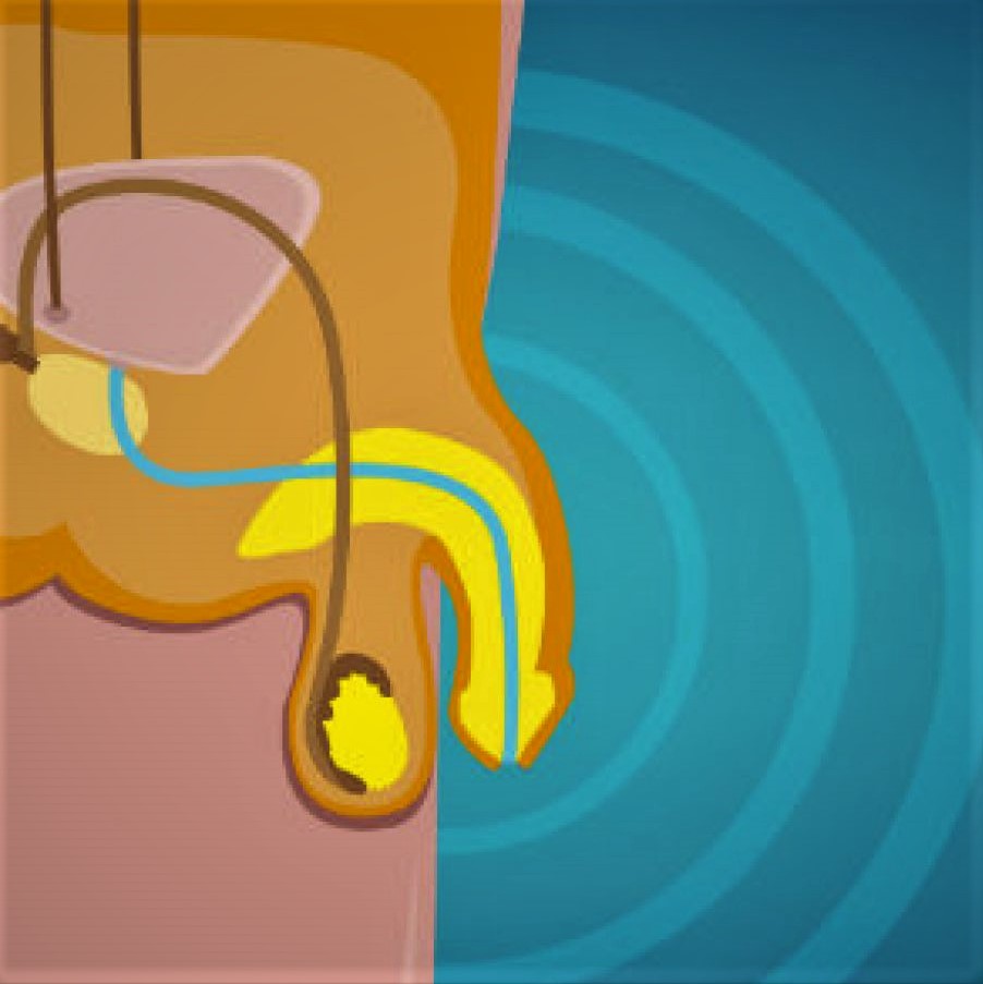 Terapêuticas da Disfunção Erétil